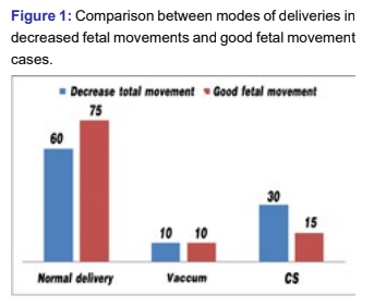 Decreased fetal movement Is it an alarm to Obstetrician and Pregnant Lady